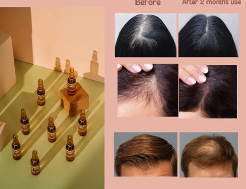 Fiale per trattamenti completi contro la caduta dei capelli con olio di Argan e Ricino