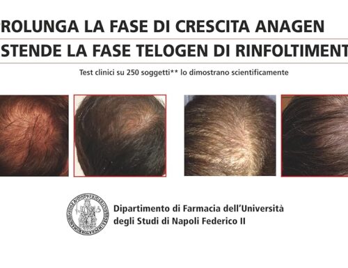 Che cos’è l’alopecia androgenetica e come combatterla consigli da farmacia